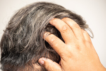 Fototapeta premium A middle-aged man is scratching his head, which is covered in gray hair, possibly due to itchy scalp, dandruff, or hair loss. Concepts related to health and skin disease treatment.
