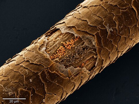 Scanning Electron Micrograph of Hair Shaft Showing Dual Pigment Granules