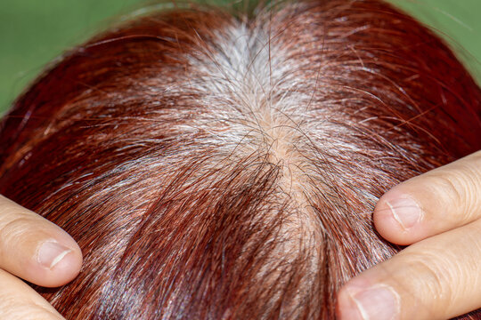 Senior aged asian woman concern about gray hair in menopause.