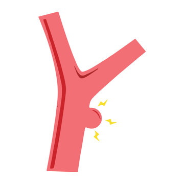 Artery aneurysm icon
