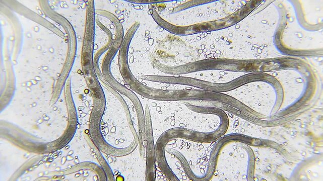 Panoramic view of large nematode roundworms in a dirty water drop under 100x brightfield microscopy magnification