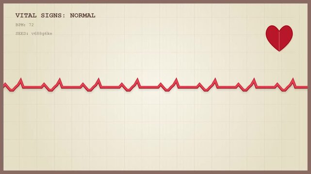 Animated heart rate monitor showing a steady normal sinus rhythm heartbeat