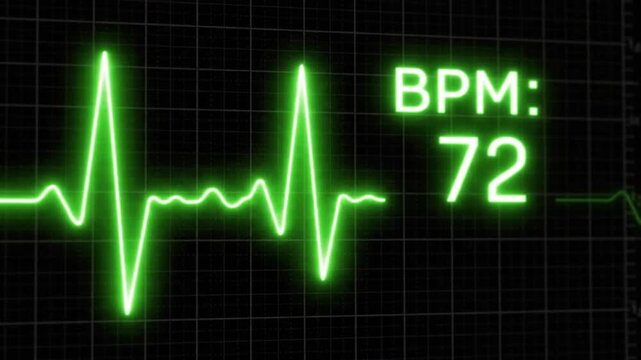 Second loop of heart monitor EGK with alpha c VSRExport showing BPM at 72 in a monitoring setting