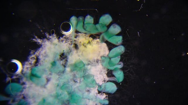 Cluster of blue green Stentor ciliates attached to organic substrate under 40x darkfield microscopy magnification
