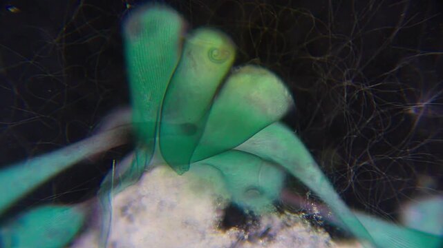 Stentor ciliates attached to substrate hunting and feeding on bacteria under 100x darkfield microscopy magnification