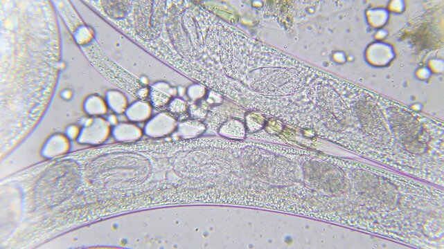 Nematode roundworm body close up showing internal eggs under 400x brightfield microscopy magnification