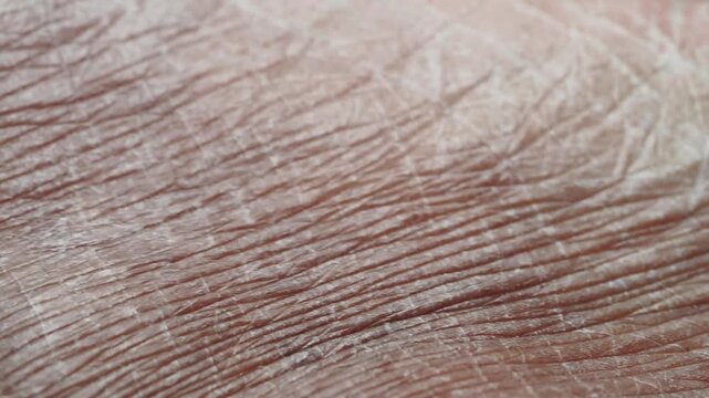 Macro footage of dry skin being touched by a finger, showing flaky texture and wrinkles, suggesting dehydration or skin condition
