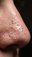 Naklejka premium Blackhead Comedones Nose Surface, Extreme Macro Close Up of Enlarged Skin Pores, Oxidized Sebum Plugs, Dermatological Skin Texture, Acne Prone Oily Skin Detail