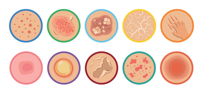 Various human skin conditions depicted in a comprehensive set of medical dermatology icons illustrating different dermatological problems and symptoms.