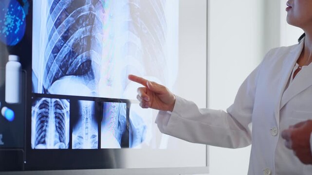 A group of male and female doctors holding a meeting while looking at a screen. Doctors, medical care, hospital, treatment, conference, clinical practice, diagnosis, surgery.