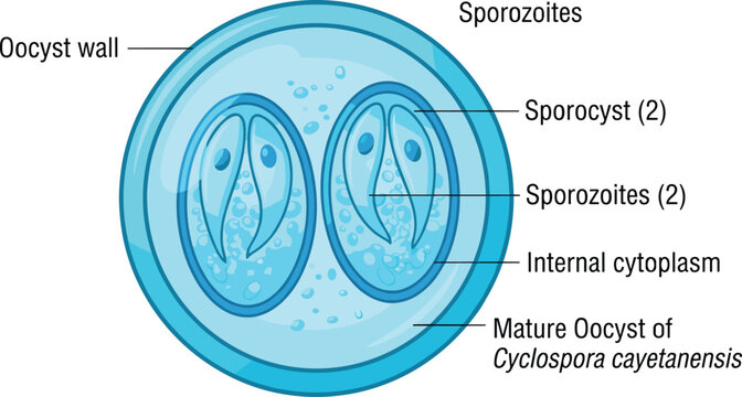 Cyclosporiasis outbreak as a foodborne parasitic illness caused by Cyclospora cayetanensis as an outbreak with contaminated food or water resulting in explosive diarrhea and digestive illness.