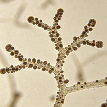 Bright-field micrograph of the fungus *Trichoderma reesei*, showing the branching structure of the conidiophores; related to mycology, biotechnology, and microscopy.