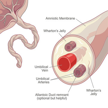 Detailed illustration of the umbilical cord structure, showing amniotic membrane, Wharton's jelly, umbilical vein, umbilical arteries, and allantoid duct remnant