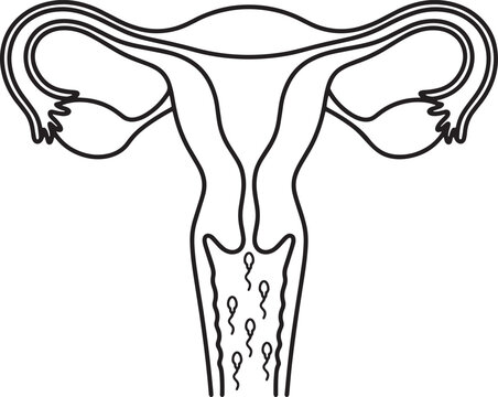 Female Reproductive System Anatomy: A diagram illustrating the female reproductive system, highlighting the uterus, fallopian tubes, and ovaries, with sperm depicted entering the cervix.