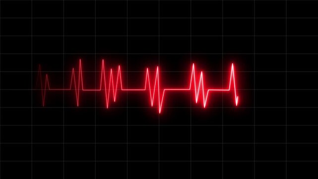 heart beat on monitor