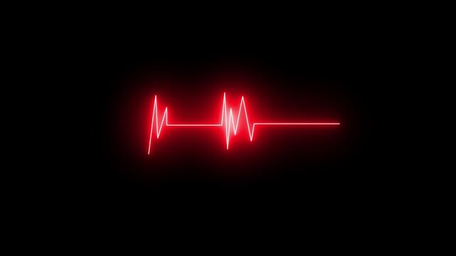 heart beat on monitor