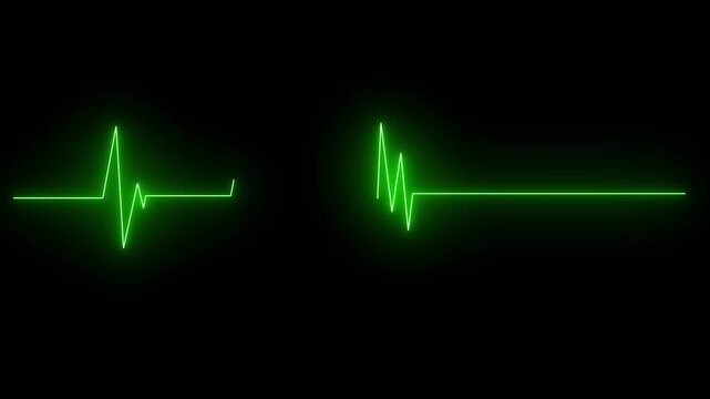 heart beat on monitor