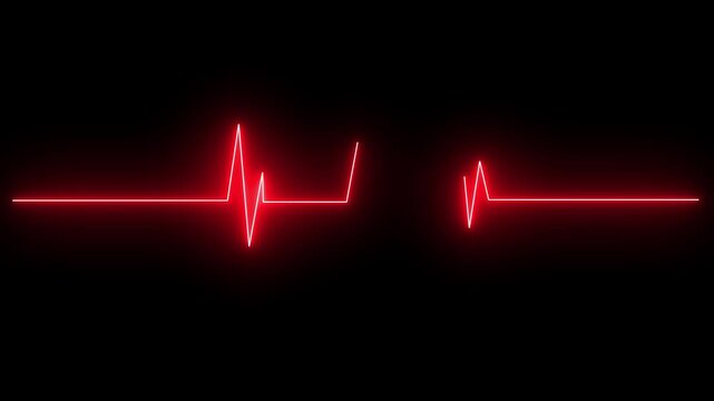 heart beat cardiogram
