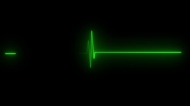 heart beat on monitor