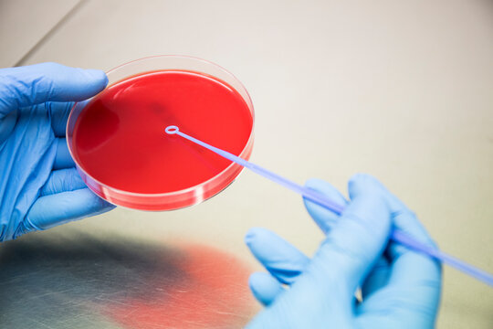 Crop hands in gloves putting samples on petri dish while working in microbiologist laboratory