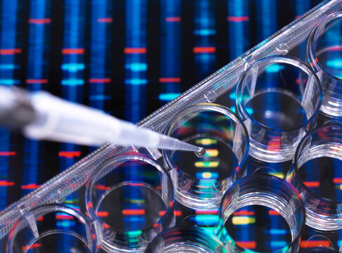 DNA Research, Samples of DNA in a multi well plate ready for analysis with DNA results in the background