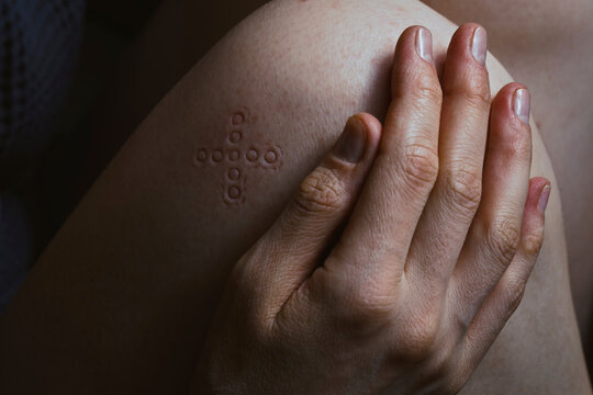 Hand resting on bare skin showing a cross shaped pressure mark