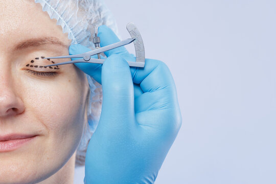 Surgeon Marking Eyelid for Blepharoplasty Procedure Preparation