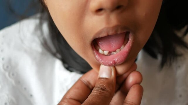 Young child opens mouth revealing healthy baby teeth with some adult teeth emerging