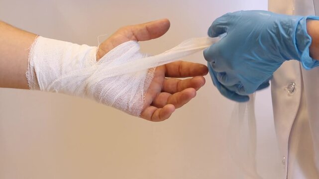 A doctor in blue gloves unbandages a person's wrist and palm. The process of removing a medical bandage from an injured hand in a hospital. Providing first aid and bandaging a hand close-up