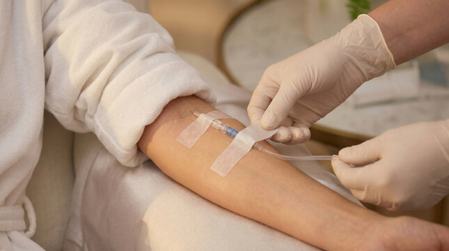 Medical professional securing an intravenous catheter on a patient's arm during vitamin infusion therapy in a modern wellness clinic, healthcare procedure, recovery support, preventive treatment.