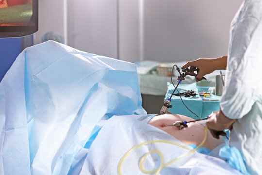 A surgeon inserts an instrument into a patient's abdominal cavity. Laparoscopic instruments. A surgeon performs laparoscopic surgery in the operating room. Minimally invasive modern surgery