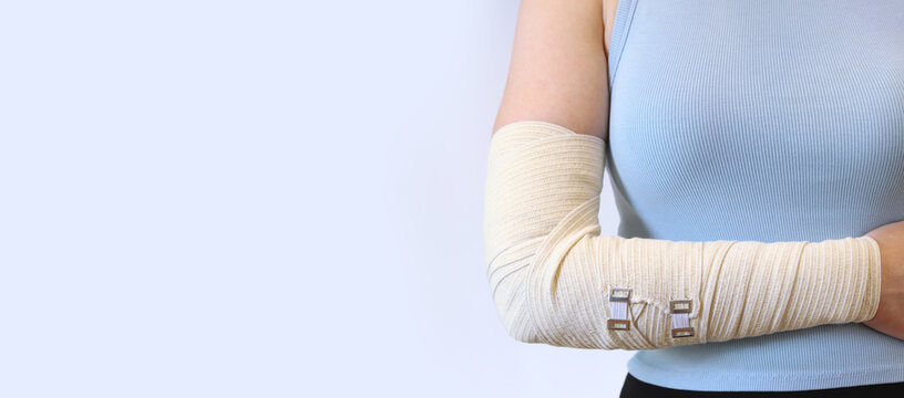 A woman's hand tightly wrapped in an elastic medical bandage and secured with metal clips on a white background. A young woman with an elbow or forearm injury, on which an elastic bandage is applied