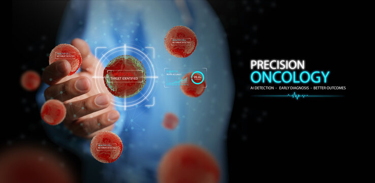 Precision oncology AI concept. Doctor or surgeon using cancer cell detection and Artificial intelligence targeting system. Early medical diagnosis, biotechnology, and advanced treatment technology.