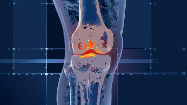A detailed three dimensional rendering of a human knee joint with highlighted cartilage showcasing anatomical structure anatomy leg
