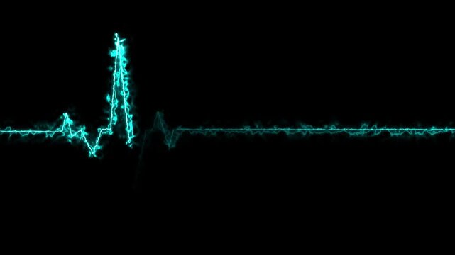 glowing heartbeat line graph with particle effects on a dark Generate title without using the word "Title:" before it. background showing sharp peaks and a flat baseline.