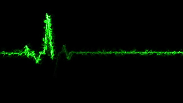 glowing heartbeat line graph with particle effects on a dark Generate title without using the word "Title:" before it. background showing sharp peaks and a flat baseline.