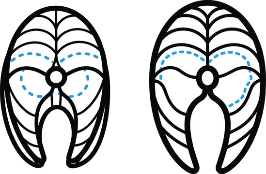 Black and white of lungs with highlighted airways and nodes lung respiratory system