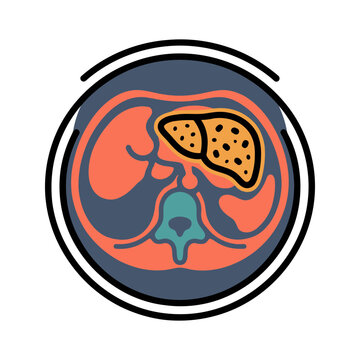 Liver Cirrhosis CT Scan Icon for Hepatology