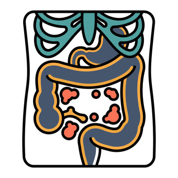 Intestinal Blockage X-Ray Icon for Digestive Health