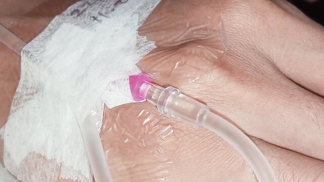 Applying adhesive and gauze to an IV line serves to secure its position (fixation), prevent needle displacement, and protect the insertion site by keeping it clean and dry while preventing infection.