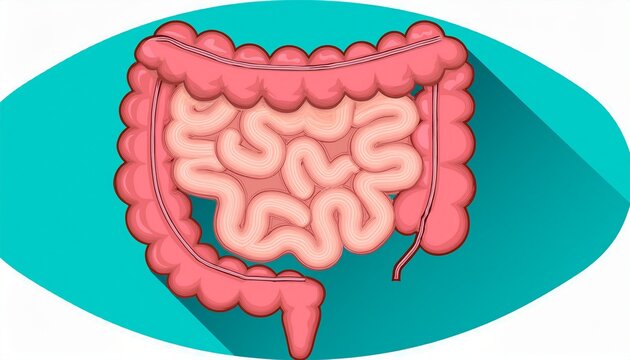 bowel cancer also known as colorectal cancer develops from the inner lining of the bowel and is usually preceded by growths called polyps which may become invasive cancer if undetected
