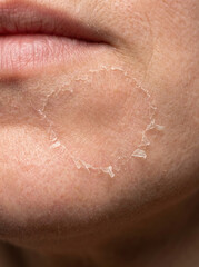 Fototapeta premium Dry skin texture macro close up reveals peeling skin around mouth area, showcasing skin health