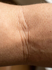 Fototapeta premium Skin texture close up showing fine lines and creases on elbow area, highlighting natural aging
