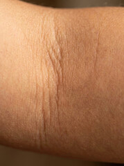 Fototapeta premium Skin fold macro image showing detailed texture and creases
