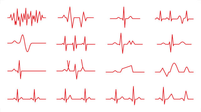 Collection of red electrocardiogram heart rhythm lines on white background representing health and medical data