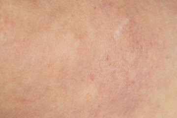 Fototapeta premium Texture of normal skin as background, closeup