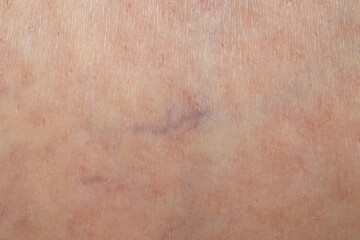 Fototapeta premium Texture of normal skin as background, closeup