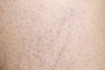 Fototapeta premium Texture of normal skin as background, closeup