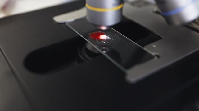 Medical worker prepares a blood sample for microscopic diagnostics by carefully positioning the glass slide under a laboratory microscope objective.
