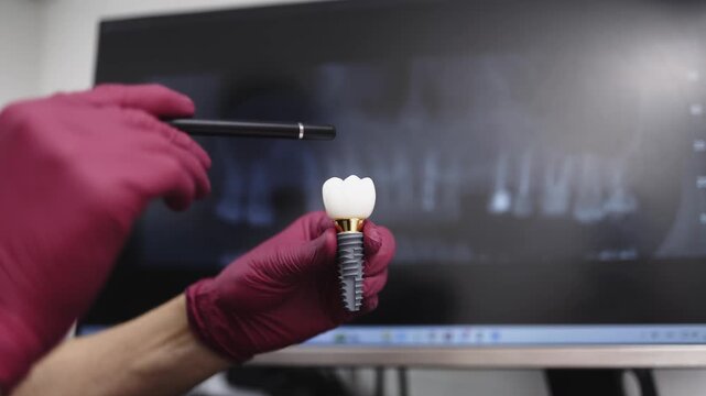 Close-up of a dental implant model with a crown in a dentist&rsquo;s hands against a patient&rsquo;s panoramic dental radiograph.
